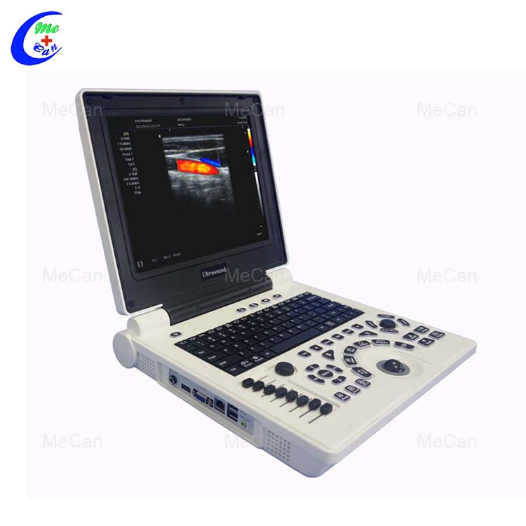 Color Doppler Ultrasound - Fetal Imaging Warna Doppler Ultrasound - fétal Imaging