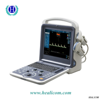 គុណភាពខ្ពស់ HUC-260 Portable Full Digital Color Doppler Ultrasound Scanner