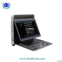 E1 Sonoscape Medical Portable Ultrasound Scanner system តម្លៃម៉ាស៊ីនអ៊ុលត្រាសោសខ្មៅ និងស