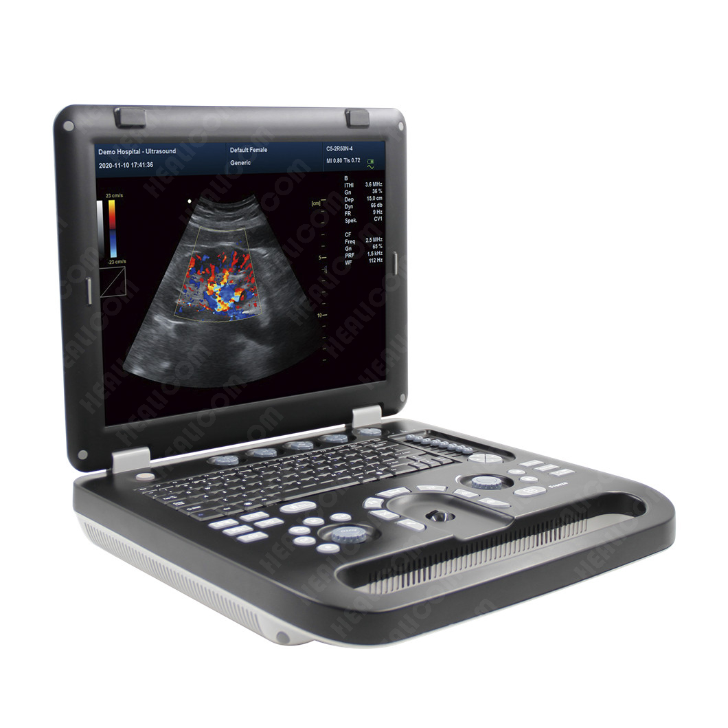 Huc Portable Color Doppler Ultrasound Scanner From China