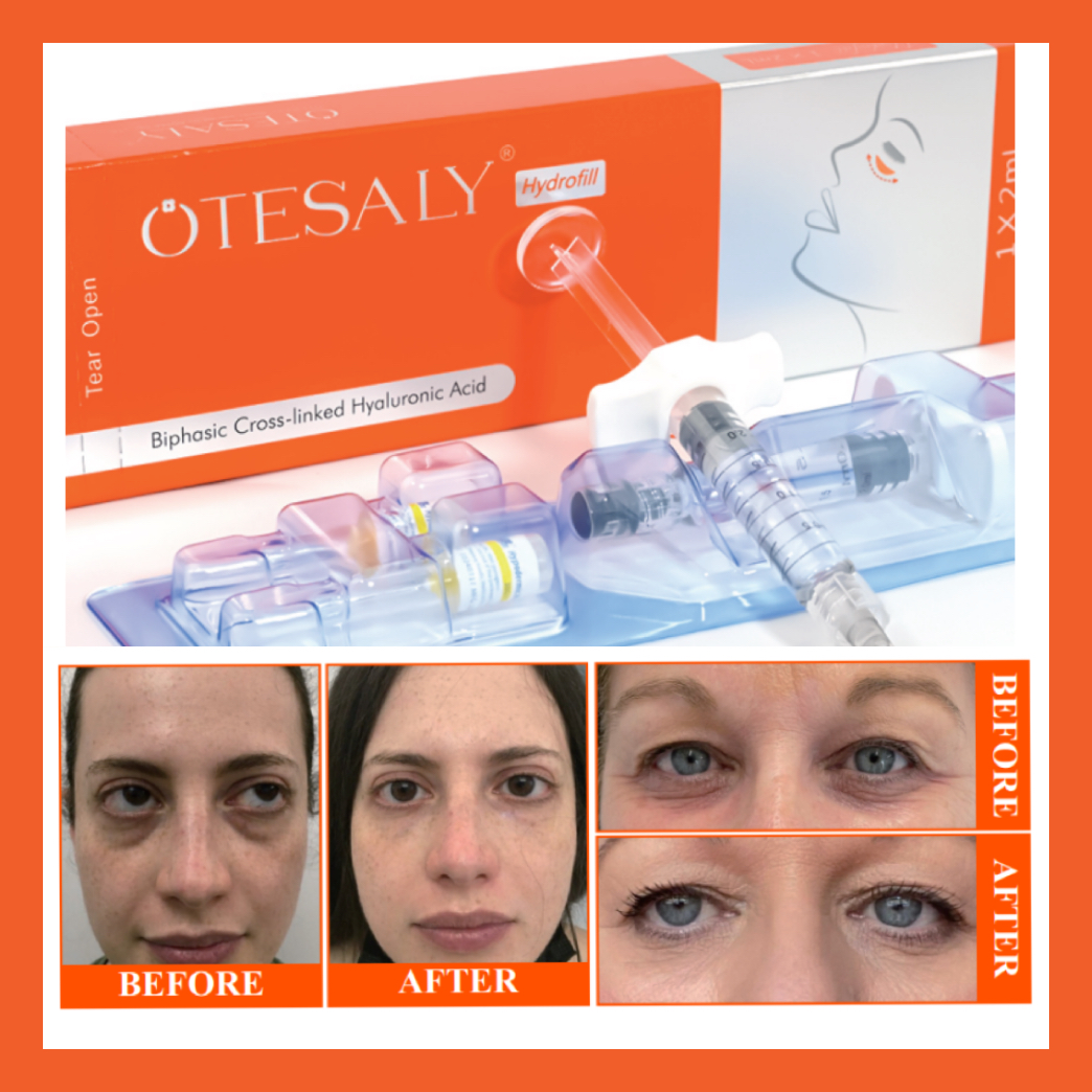 Before & After of Hydrofill 水填充之前和之后