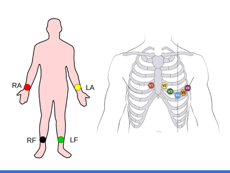 ECG Electrode Placement Key Components Komponen Utama Penempatan Elektrod ECG