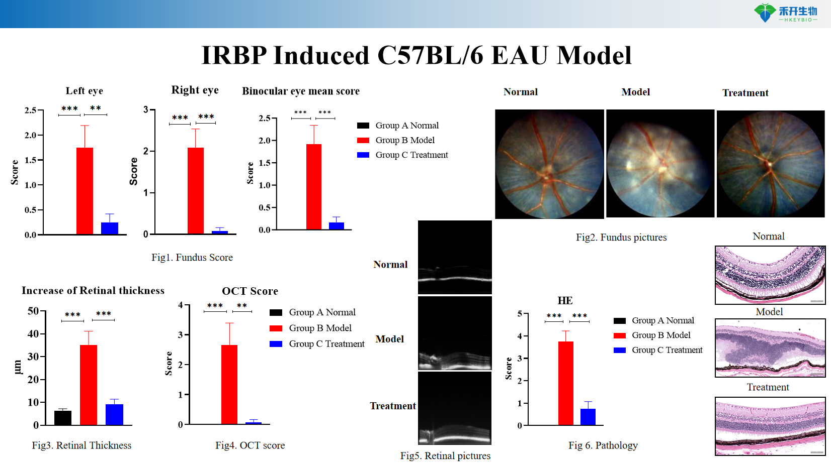 IRBP Induced C57BL/6 EAU Model 4e21dfc5d7adfb7fd1833a7e2f72c696