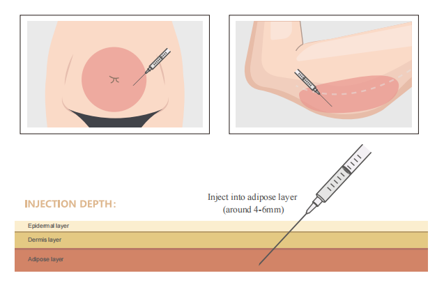 Semaglutide Mechanism of Action 索馬魯肽作用機制