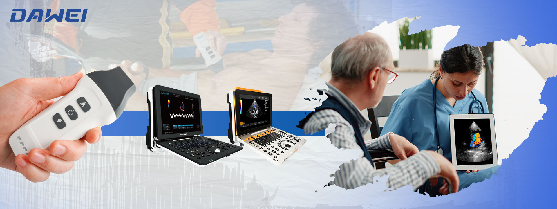 Why Portable Cardiac Ultrasound Machines Are Revolutionizing Heart Health Diagnostics لماذا تُحدث أجهزة الموجات فوق الصوتية المحمولة للقلب ثورة في تشخيص صحة القلب
