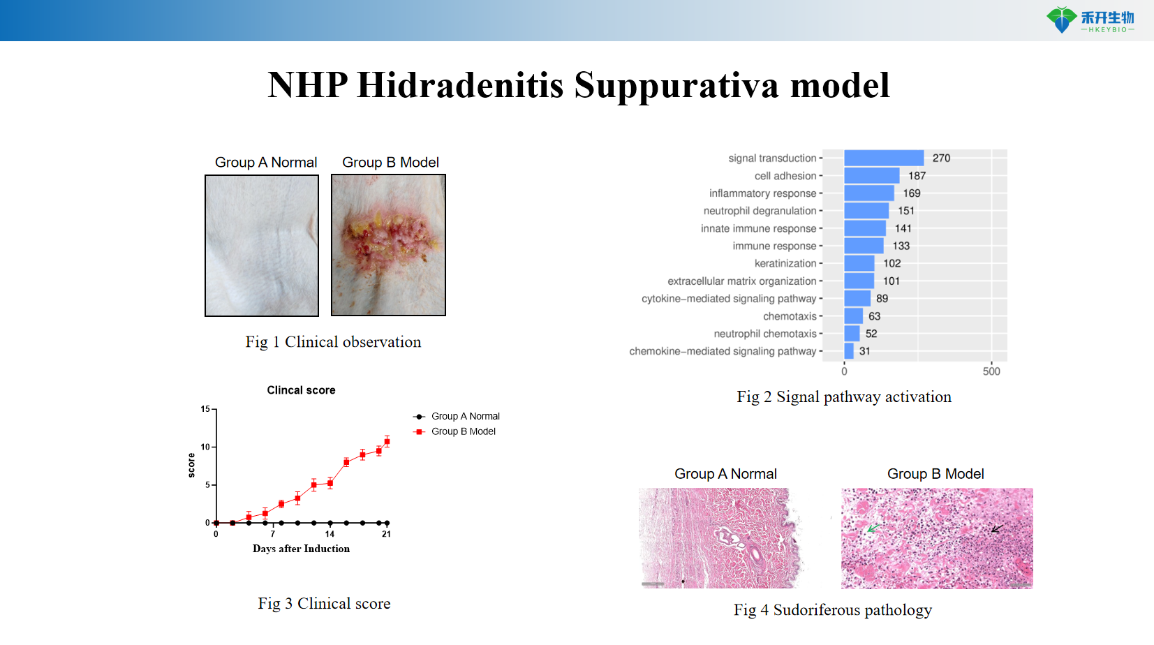 NHP Hidradenitis Suppurativa model-01 1
