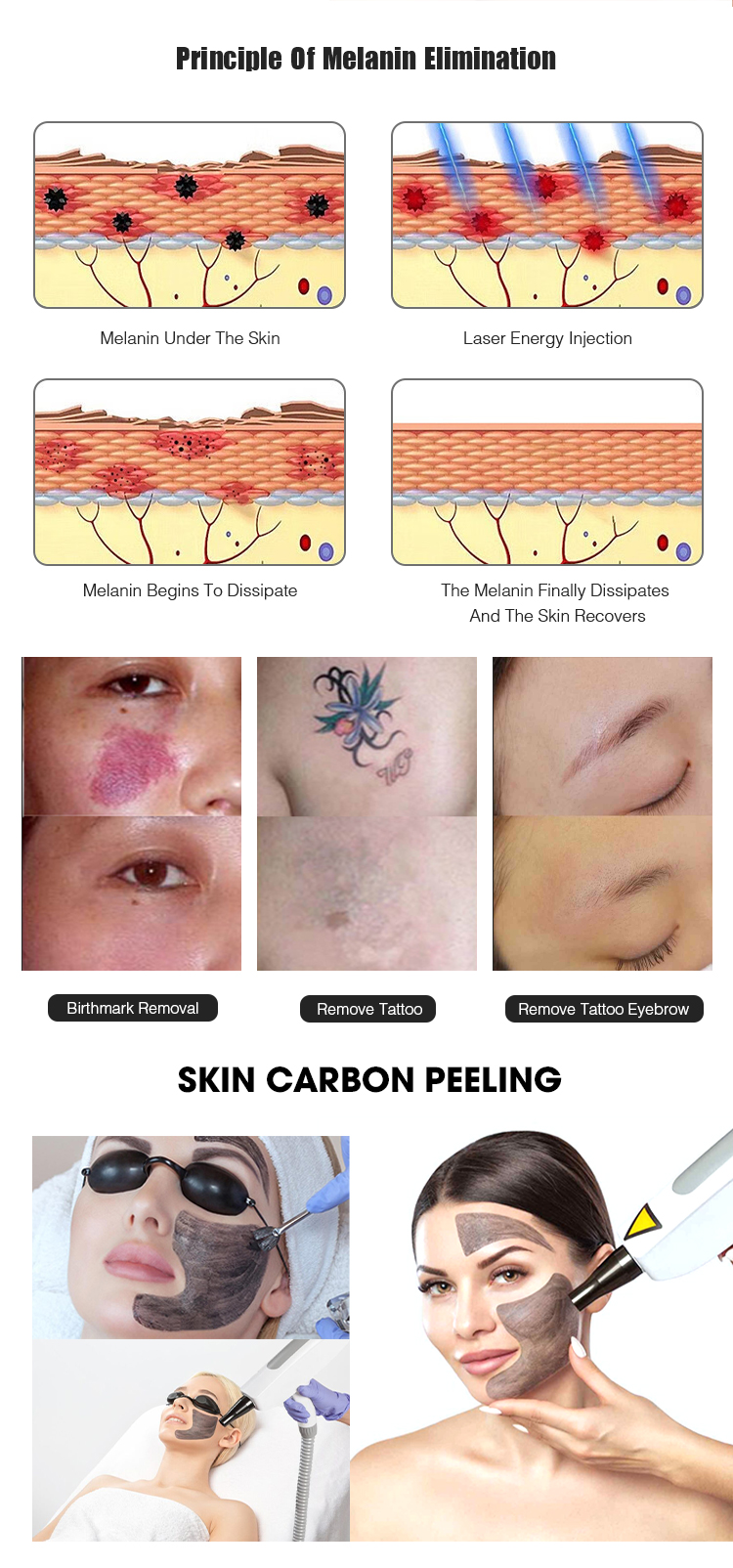 SHR IPL YAG RF Laser Hair Removal Machine Machine d'épilation au laser SHR IPL YAG RF