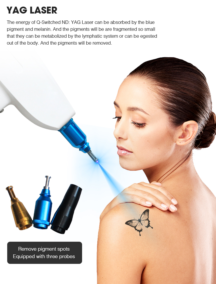 SHR IPL YAG RF Laser Hair Removal Machine Machine d'épilation au laser SHR IPL YAG RF