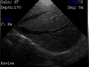 ឧបករណ៍វេជ្ជសាស្ត្រ HV-3 Palm Veterinary Ultrasound Scanner Diagnostic Vet Ultrasound