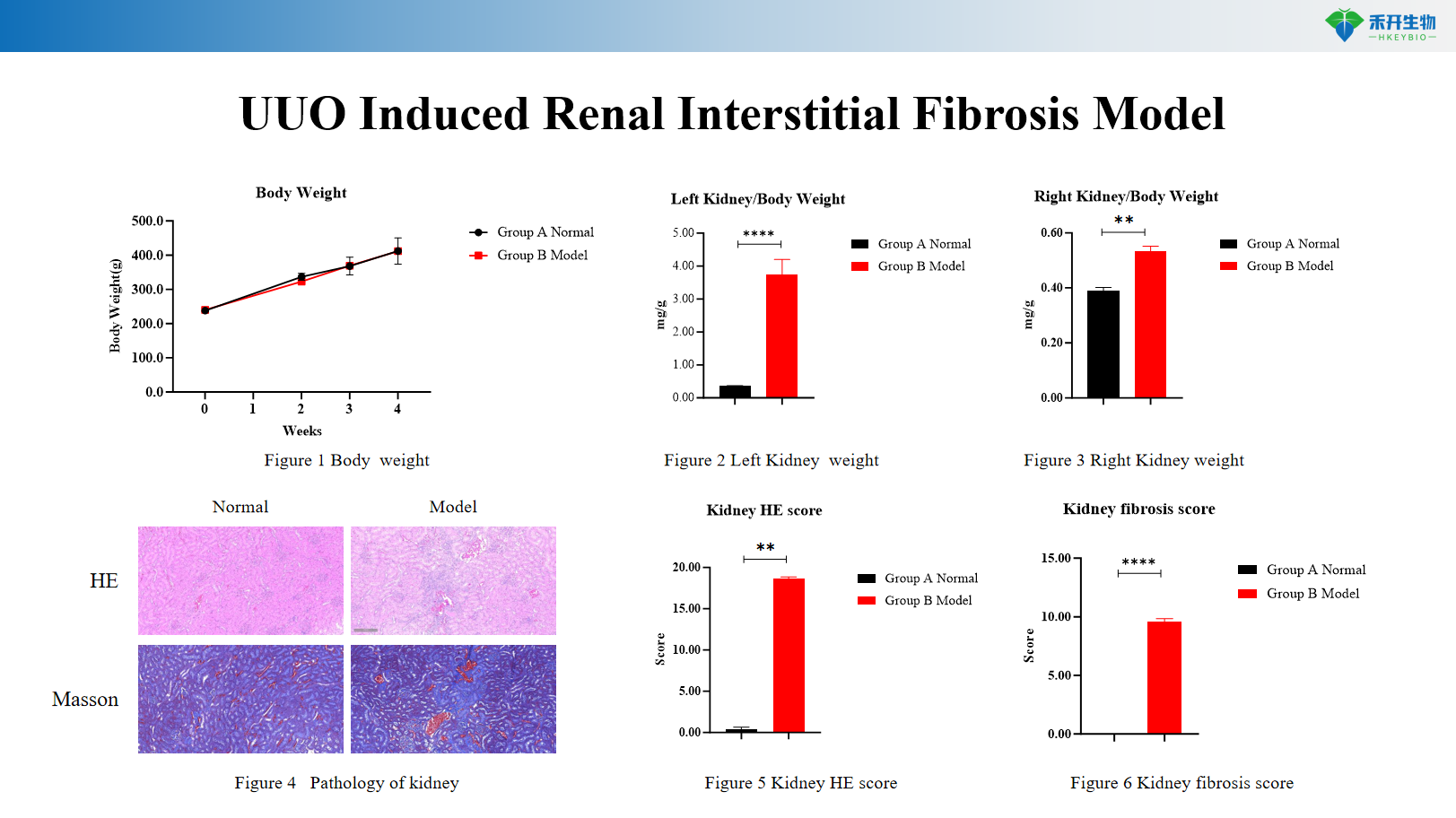 UUO Induced Renal Interstitial Fibrosis Model c495f386451d13986e7bae609eb96e38