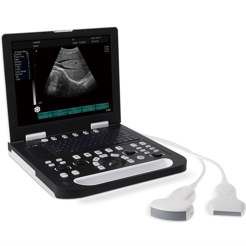 DP-50 B/W Full digital Laptop Ultrasound Machine 