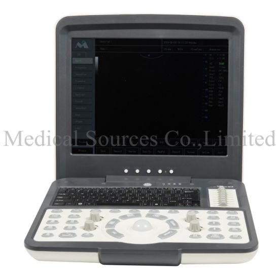 (MS-5600) Medical Laptop Notebook Color Doppler Portabel 3D/4D Ultrasound Scanner