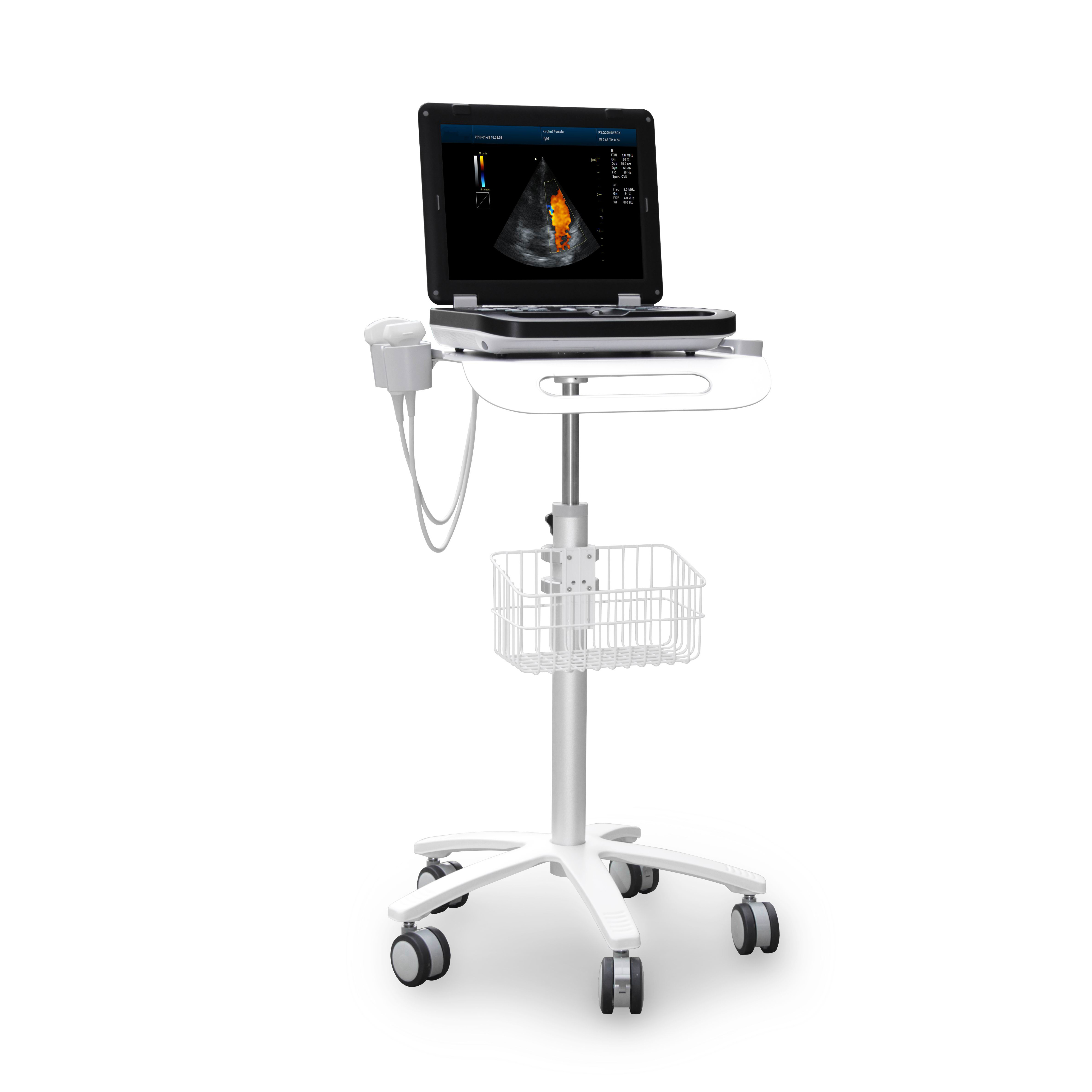 MS-C3000 Color Doppler Ultrasound Scanner·Large screen display
