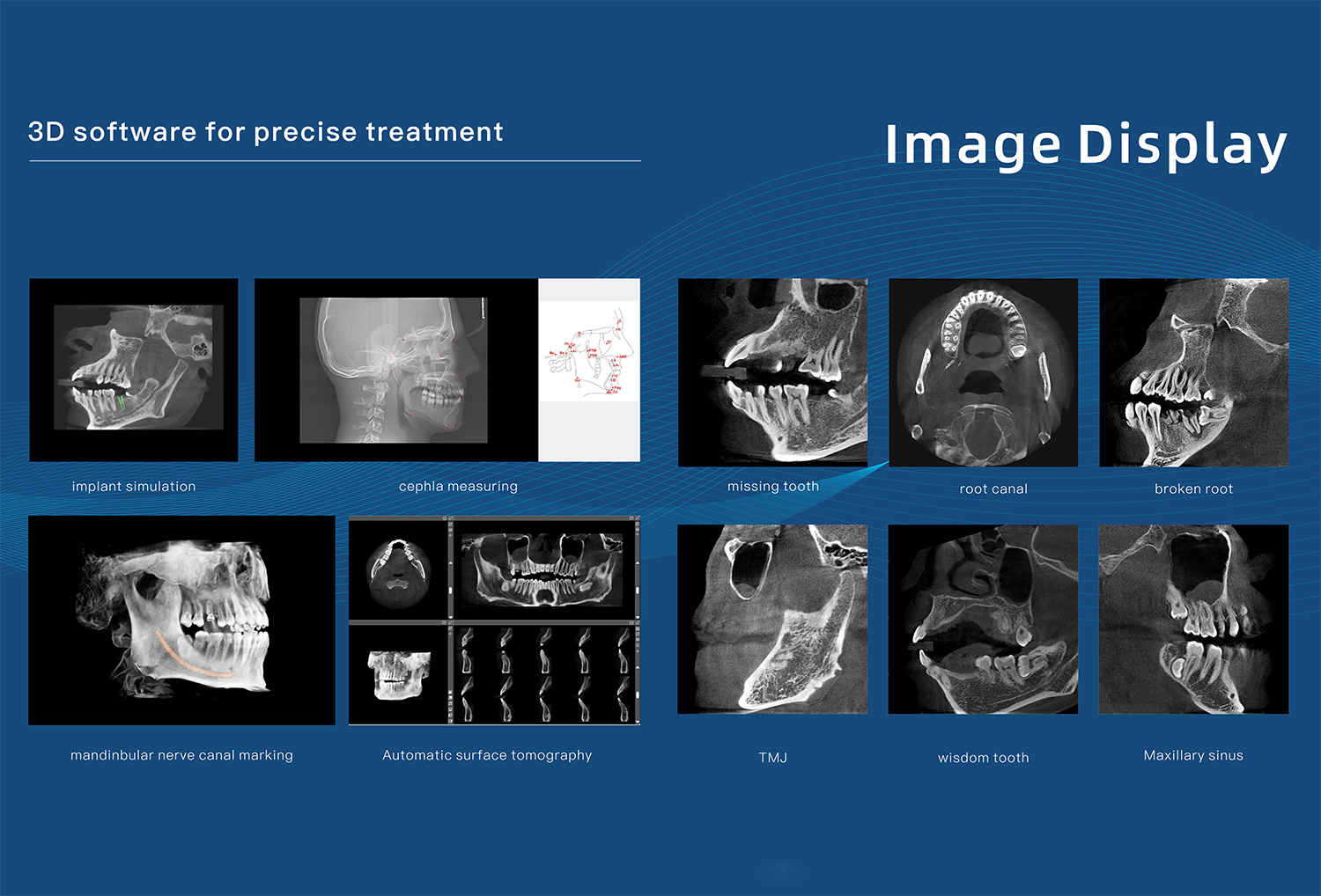 CBCT-1 (6)