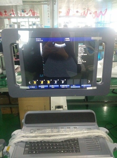Sistema diagnostico medico HUC-800 Scanner a ultrasuoni Doppler a colori completo del carrello 4D di Digital