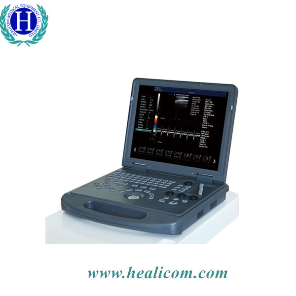 HUC-200 Дешевая цена Ноутбук Портативный цветной допплеровский ультразвуковой сканер 2D