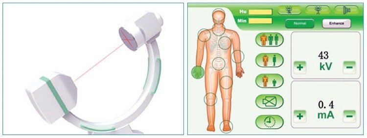 HX7000A высокочастотный цифровой мобильный рентген C-ARM