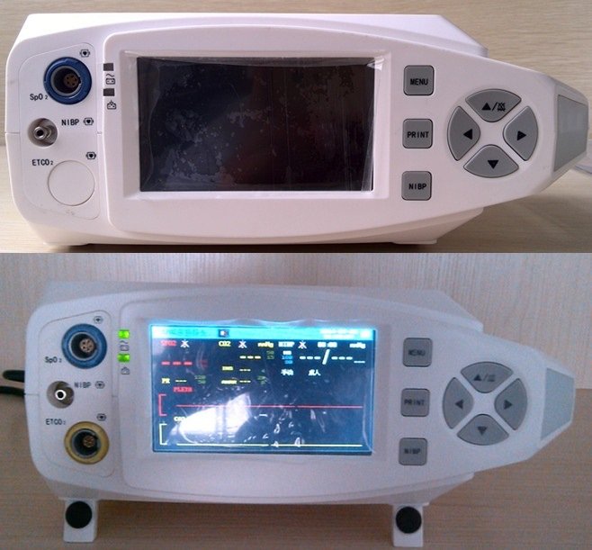 HP-810 Medizintisch-Top-Oximeter mit NIBP