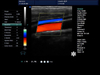 Scanner ad ultrasuoni per carrello con sistema diagnostico ad ultrasuoni HUC-600 2D Color Doppler