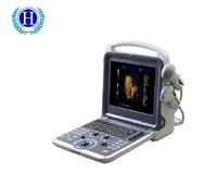 Scanner diagnostique portatif d'ultrason de Doppler de couleur du matériel médical HUC-300 4D