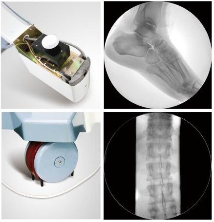 Chine Usine de matériel médical à haute fréquence C-arm mobile à rayons X
