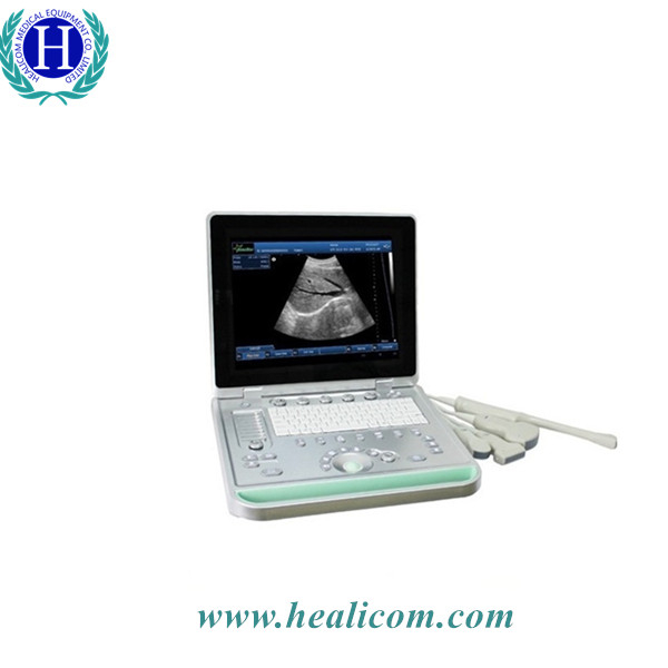 Scanner de ultrassom B para laptop baseado em PC seguro HBW-9