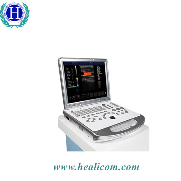 HUC-250 2D/3D Laptop / tragbarer Farbdoppler-Ultraschallscanner