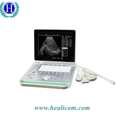 Système de diagnostic portatif d'ultrason de scanner d'ultrason d'ordinateur portable de HBW-7 B/W
