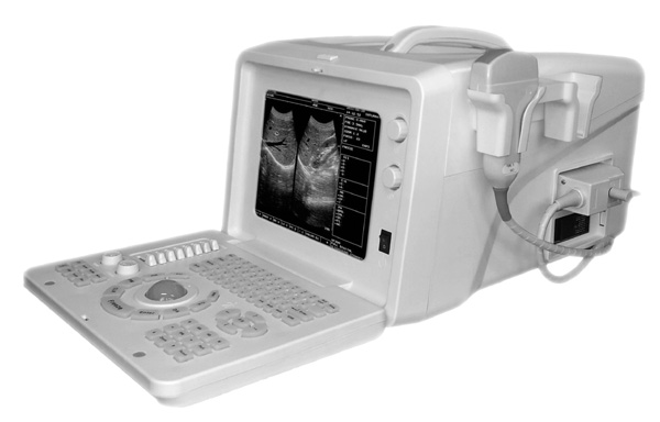 HBW-5Plus Ultrasuoni portatili economici dell'analizzatore ad ultrasuoni della macchina ad ultrasuoni