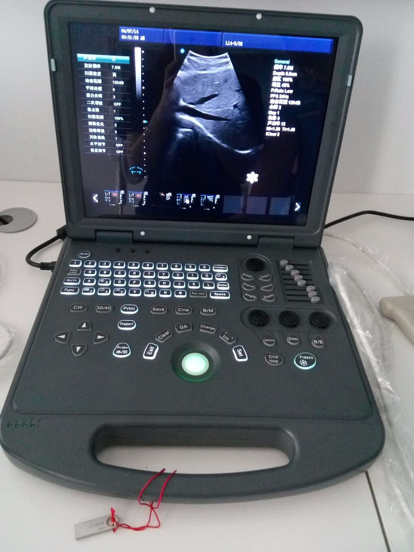 HUC-200 Scanner a ultrasuoni portatile a colori Doppler portatile a prezzi economici per notebook 2D