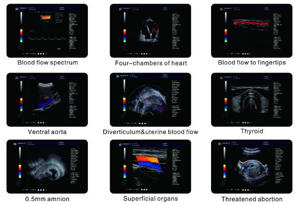 Gi&aacute; cả cạnh tranh HUC-800 4D Doppler si&ecirc;u &acirc;m Hệ thống si&ecirc;u &acirc;m chẩn đo&aacute;n 4D