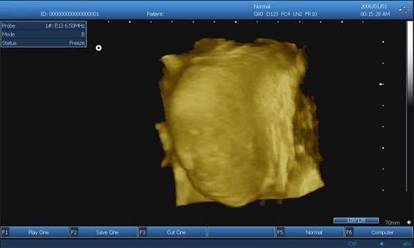 HBW-9 Scanner B ad ultrasuoni per laptop sicuro basato su PC