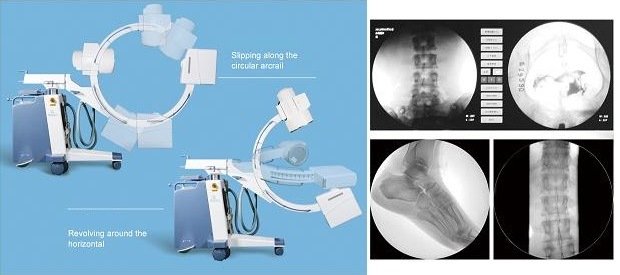 Цифровая высокочастотная мобильная рентгеновская система C-ARM