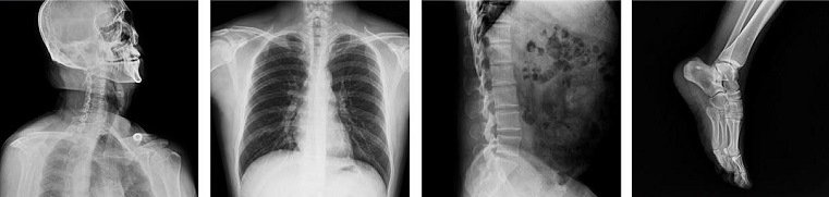 Radiografia del sistema ad alta frequenza digitale a raggi X