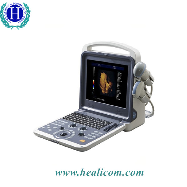 Escáner de diagnóstico por ultrasonido Doppler color portátil 4D de equipamiento médico HUC-300