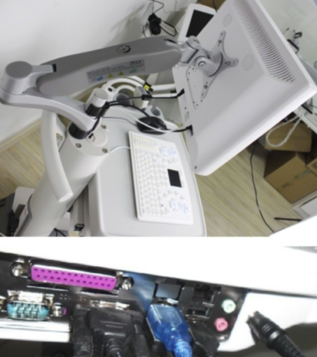 Scanner diagnostico ad ultrasuoni per carrello touch screen completamente digitale di nuovo design HBW-100