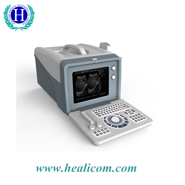 HBW-5Plus แบบพกพาราคาถูกเครื่องตรวจอัลตราซาวนด์เครื่องอัลตราซาวด์ Ultrasound