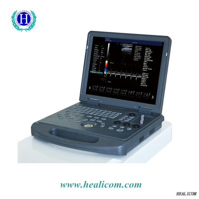 HUC-200 កុំព្យូទ័រ​យួរដៃ ម៉ាស៊ីន​ឌីជីថល​ចល័ត​វេជ្ជសាស្ត្រ Color Doppler 3d ម៉ាស៊ីនស្កែនអ៊ុលត្រាសោន