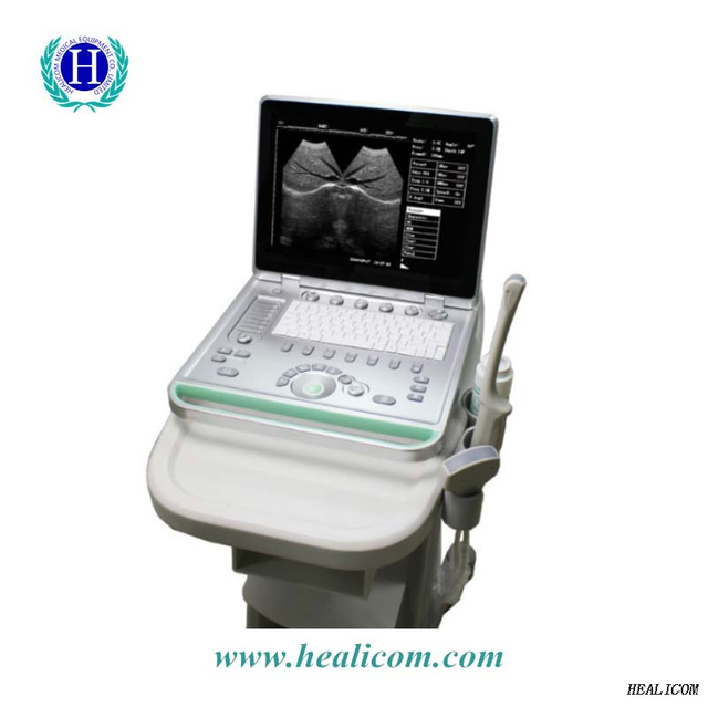 HV-7 Volldigitaler B-Modus Tragbarer Laptop Medizinischer Veterinär-Ultraschall-Scanner Diagnostisches Tierarzt-Ultraschallgerät