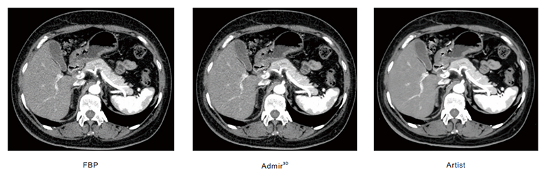 Degdeg_20231115_224058