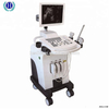 Sistema de ultrassom médico HBW-11 PLUS Scanner de ultrassom com carrinho totalmente digital de 15 polegadas