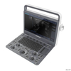 Das SonoScape E2 Professional Hospital verwendet ein volldigitales Farbdoppler-Ultraschallgerät-Diagnosesystem