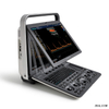 Sonoscape S8 Exp Ultrasound 3D 4D Full Digital Trolley Color Doppler Ultrasound Scanner với CE