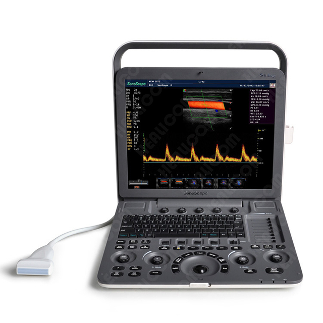Sonoscape S8 Exp Potable 4D Color Doppler Ultrasound Machine
