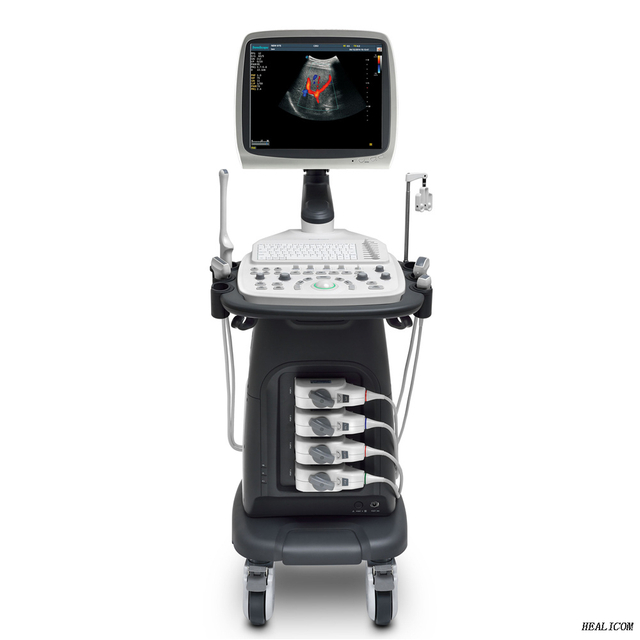 Scanner à ultrasons Doppler couleur de chariot à ultrasons entièrement numérique Sonoscape S12 de haute qualité