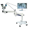 YDJ-II High Resolution Optical Colposcopy Vaginal Microscope
