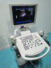 HBW-10 Plus Preço competitivo Equipamento médico Scanner de ultra-som portátil totalmente digital