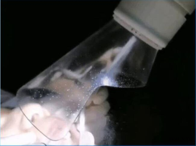 Dispositif d'aspiration orale externe portable HS-E1000