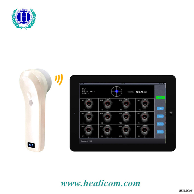 Máquina de ultrassom Scanner de bexiga sem fio Mini Sonda de ultrassom