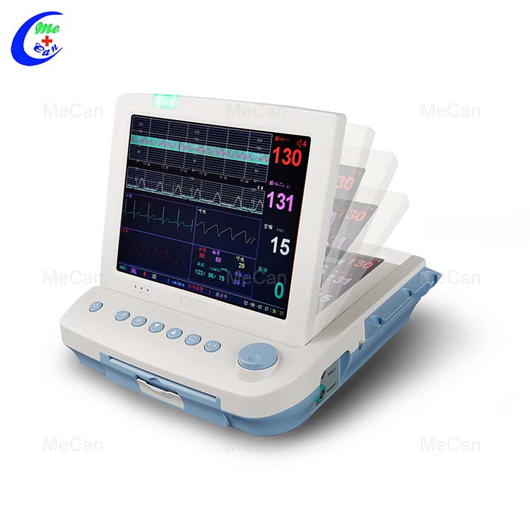 vaisiaus motinos monitorius yra 